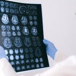 עלות בדיקת MRI פרטית